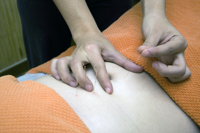 osteopathe-CAGNES SUR MER-min_acupuncture-4175625